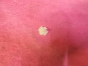 60719155  MOLLETTA ALFA ORIGINALE