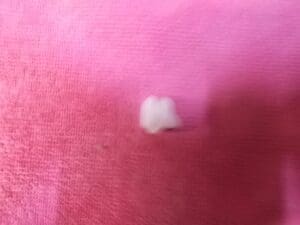 60507749 CLIP FISSAGGIO RIVESTIMENTO ALFA 75 164 NUOVO ORIGINALE